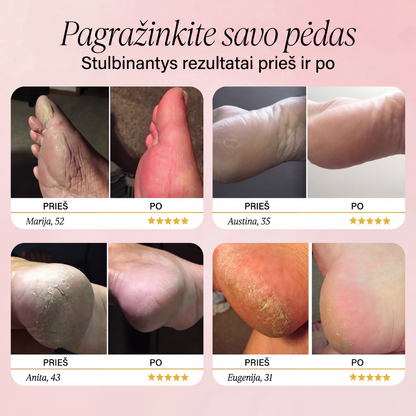 BLIME™ Elektrinis Pėdų Šveitiklis