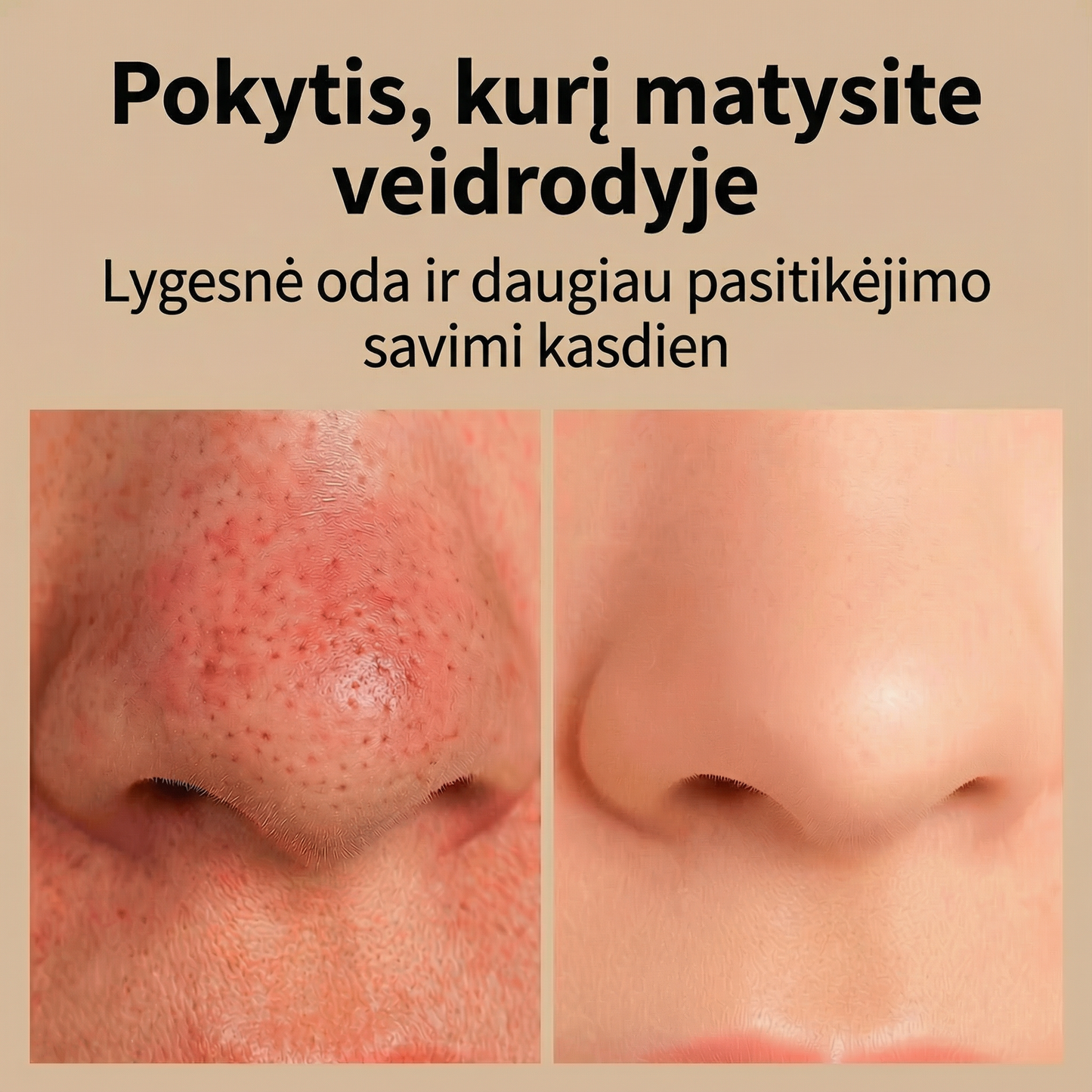 BLIME™ Inkštirų Valymo Įrenginys