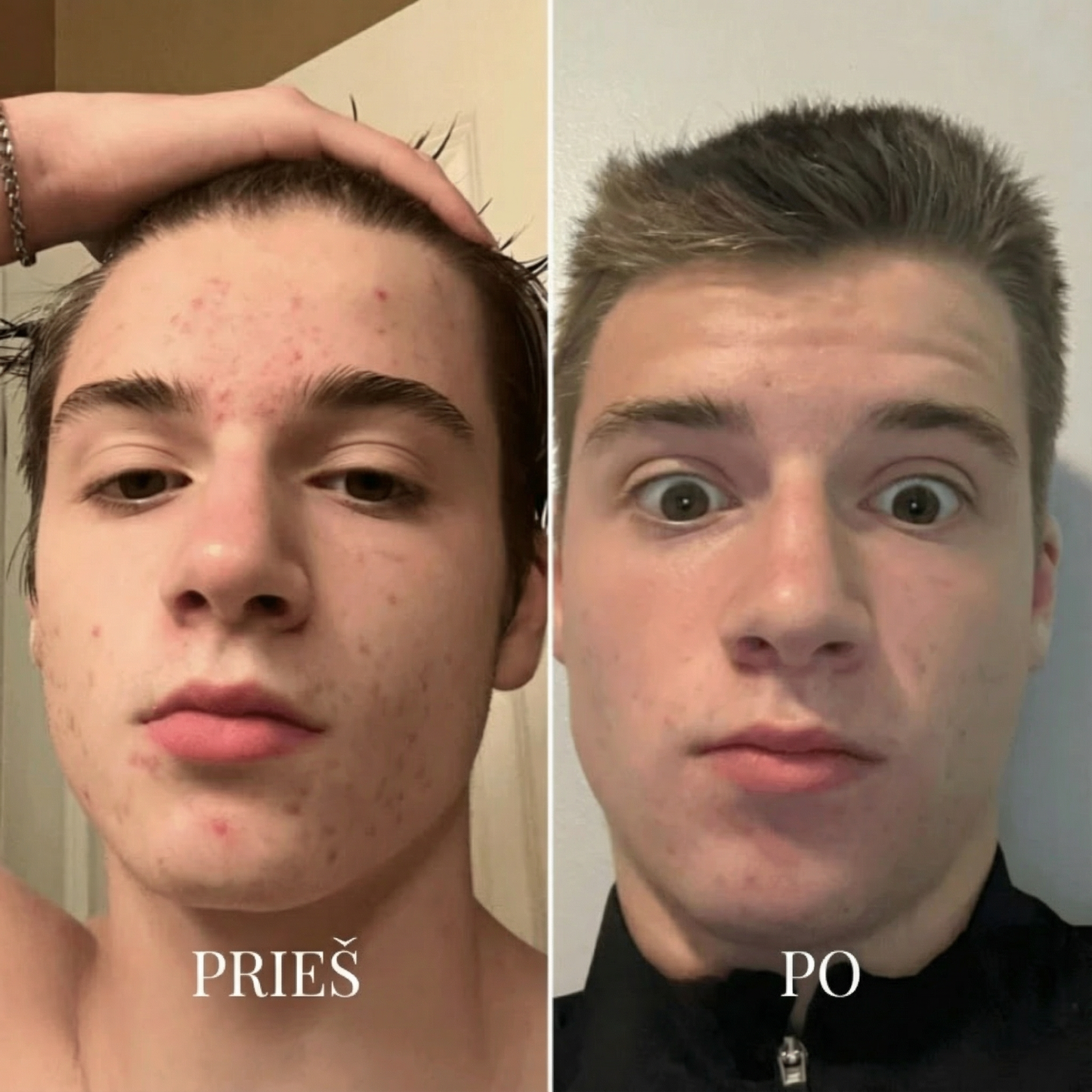 BLIME™ Inkštirų Valymo Įrenginys